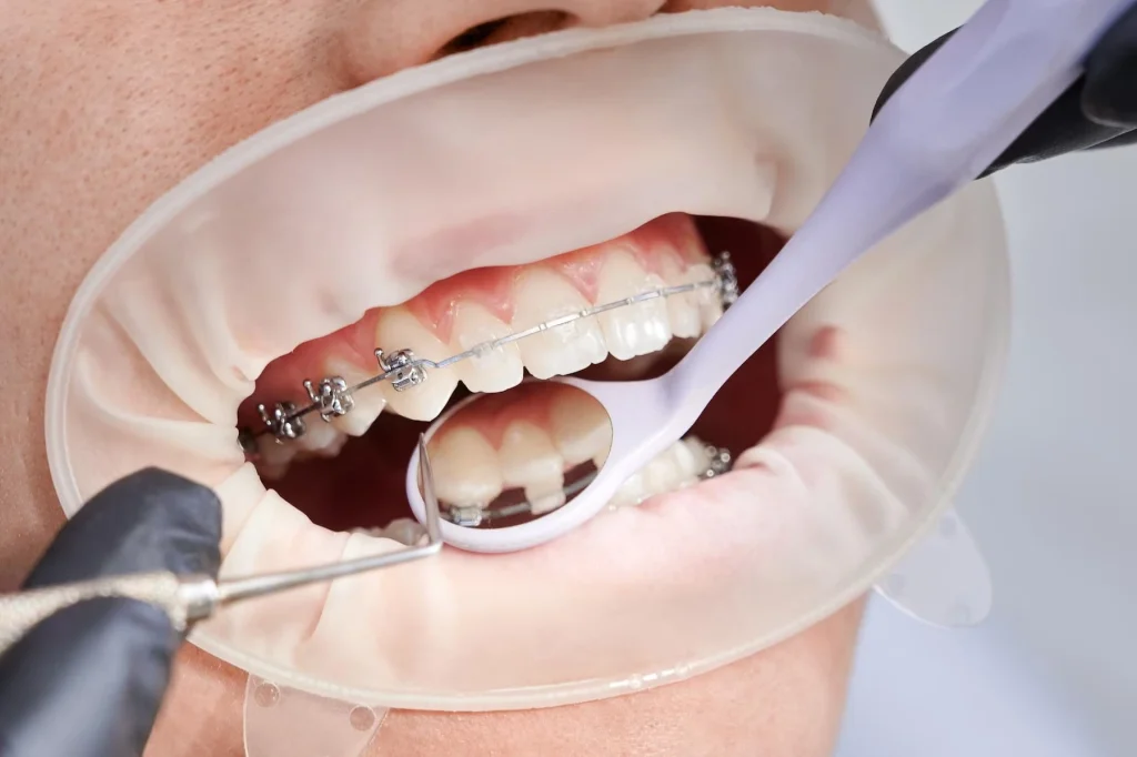 dentist maintaining oral health to a patient