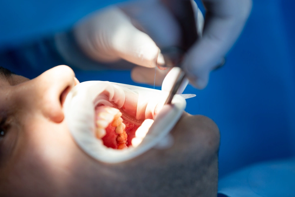 dental crown complications