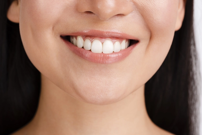 teeth whitening