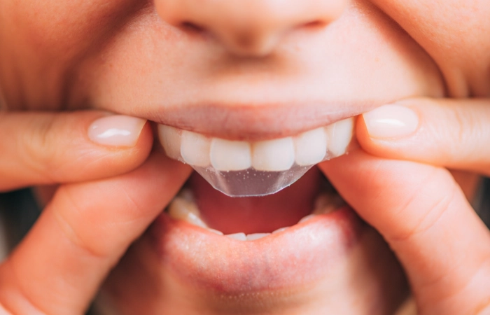 whitening strips