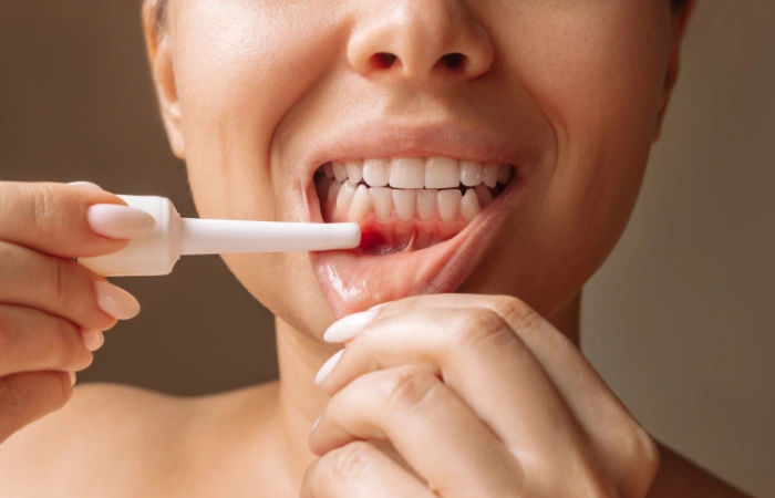 types of gum disease