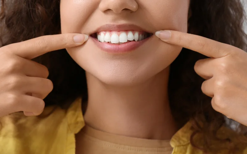 fluoride treatments and x-rays