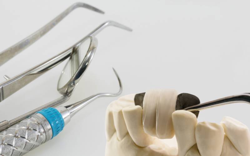 Dental Bridge in Bradenton