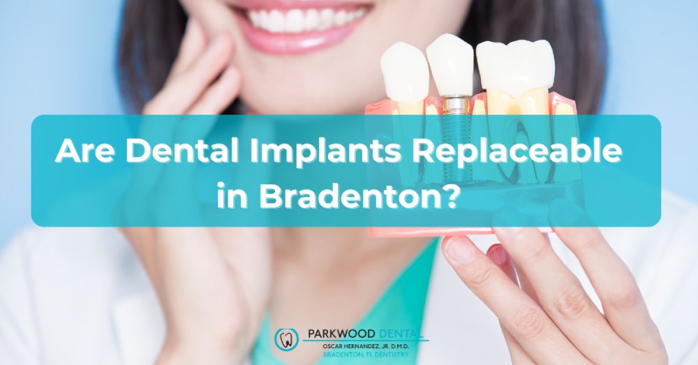 Can Dental Implants Be Replaced in Bradenton?