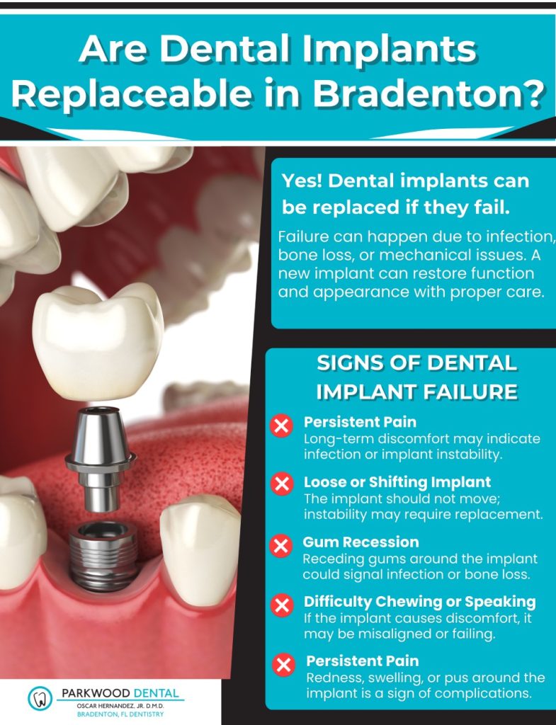 Can Dental Implants Be Replaced in Bradenton?